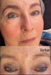 Microblading 
